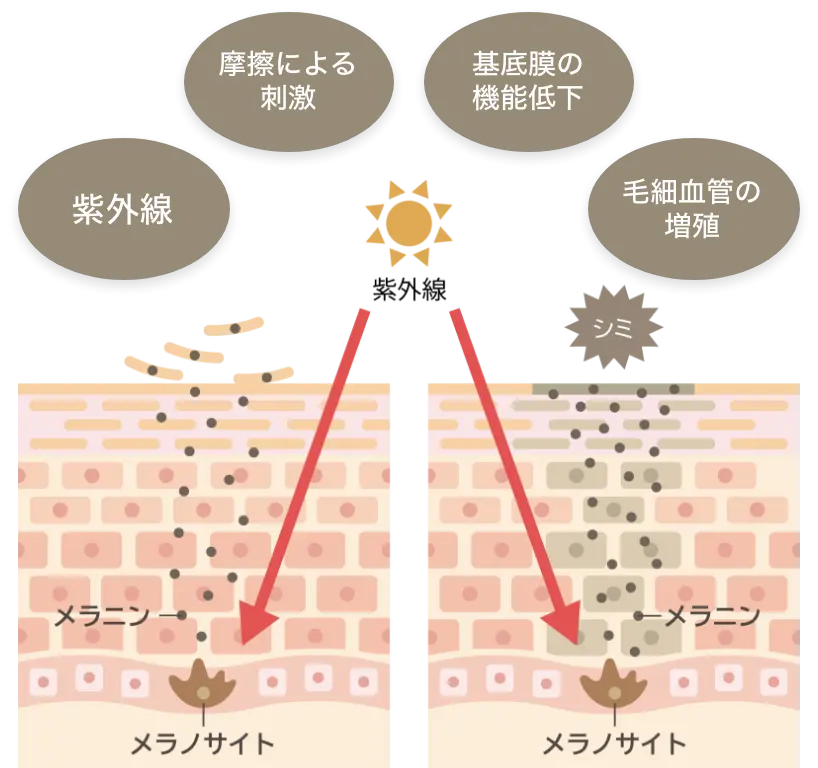 メラニン生成のイラスト
